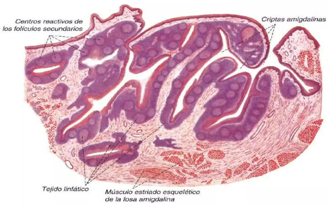 Celulite amigdaliana e abscesso amigdaliano - Distúrbios do ouvido